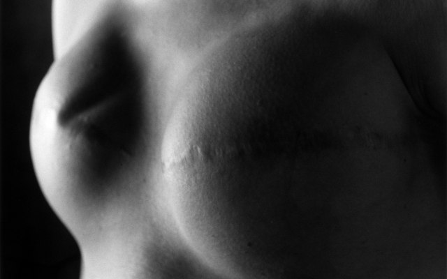 石內都，用全身表達愛與痛的攝影師